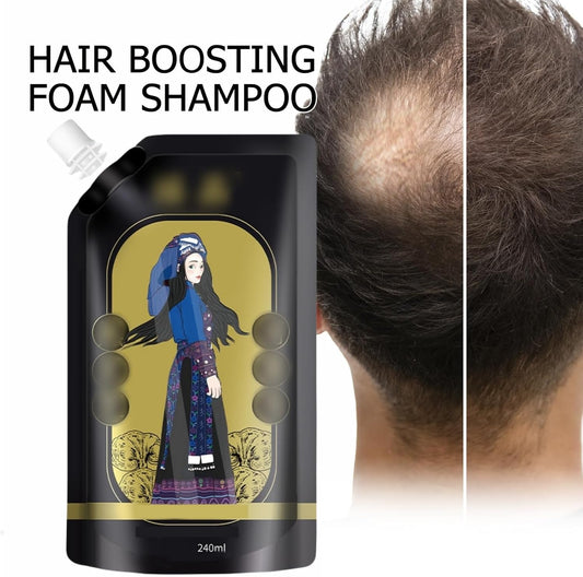 Gingerraâ˘ď¸Ginger Extract Anti-Hairfall Shampoo (Pack of 3)